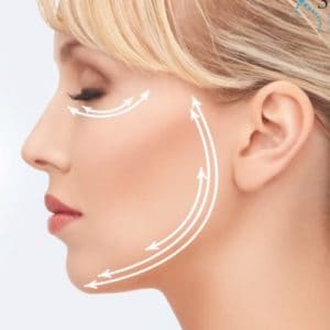 Fili per la medicina estetica